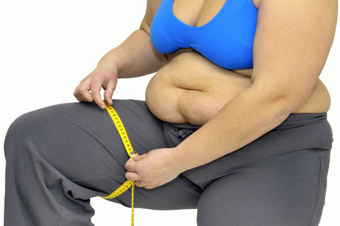 obesity-female